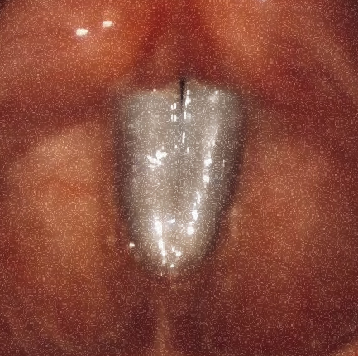 Vocal Cords.jpg